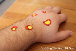 The Plague of Boils 3